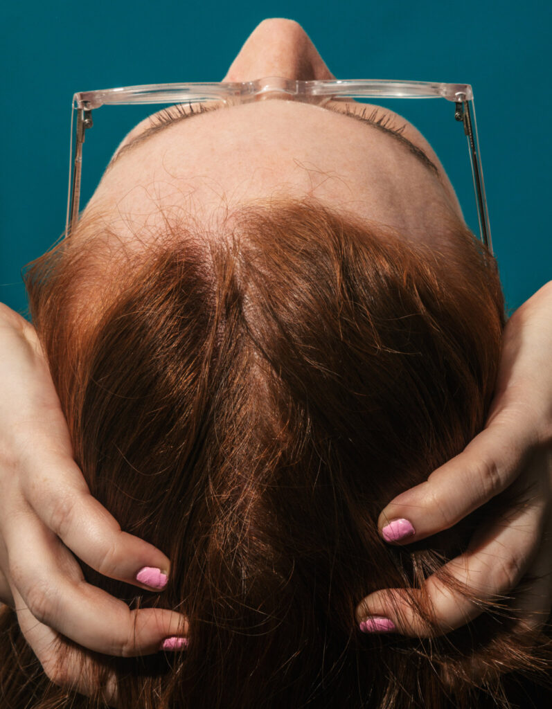 Can Hormonal Changes During Menopause Cause Hair Loss in Women?