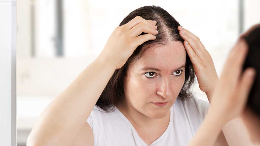 What Are the Most Common Types of Hair Loss and Their Causes