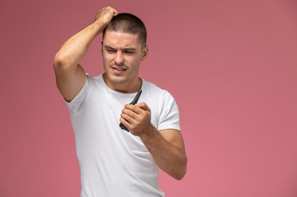 Young man in his 20s showing early male pattern baldness signs