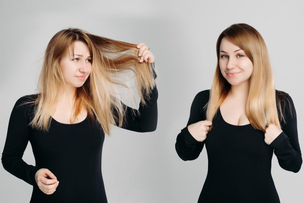 Hair density vs hair loss understanding normal thinning
